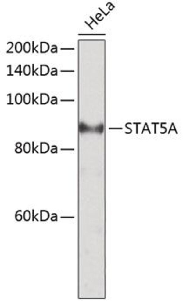 Anti-STAT5 Antibody, Density (D) 1 g/cm³, Storage temp. +4 °C - Luminix Health