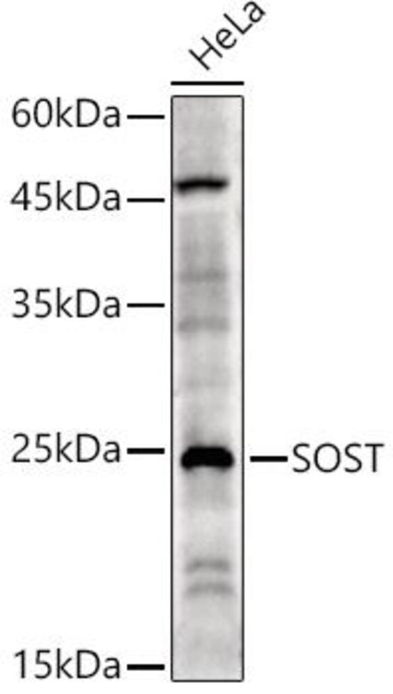 Anti-Sclerostin Antibody, 100 µl - Luminix Health