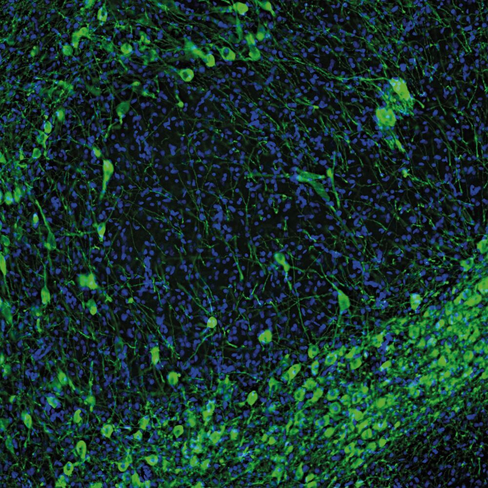 Anti-Tyrosine Hydroxylase Antibody, 50 µl - Luminix Health