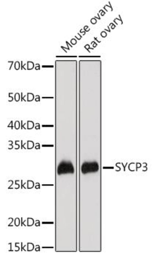 Anti-SCP3 Antibody, 100 µl - Luminix Health