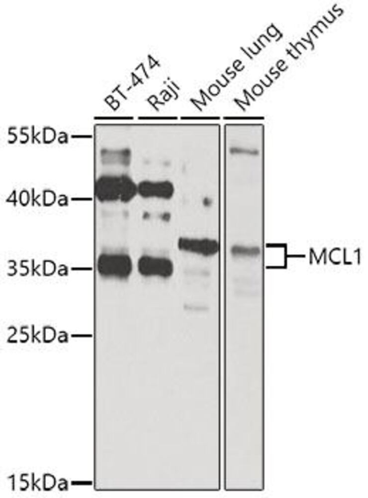 Anti-MCL1 Antibody, 100 µl - Luminix Health