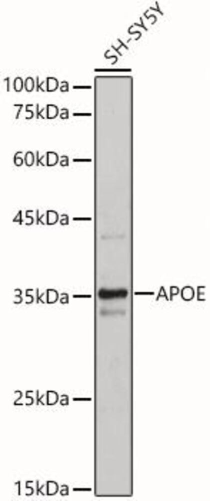 Anti-Apolipoprotein E Antibody, 100 µl - Luminix Health