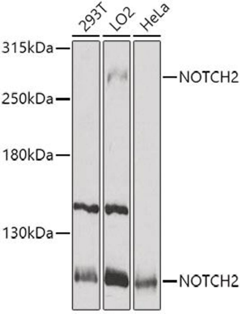 Anti-Notch2 Antibody, 100 µl - Luminix Health