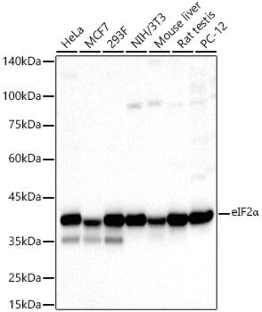 Anti-EIF2S1 Antibody, 100 µl - Luminix Health