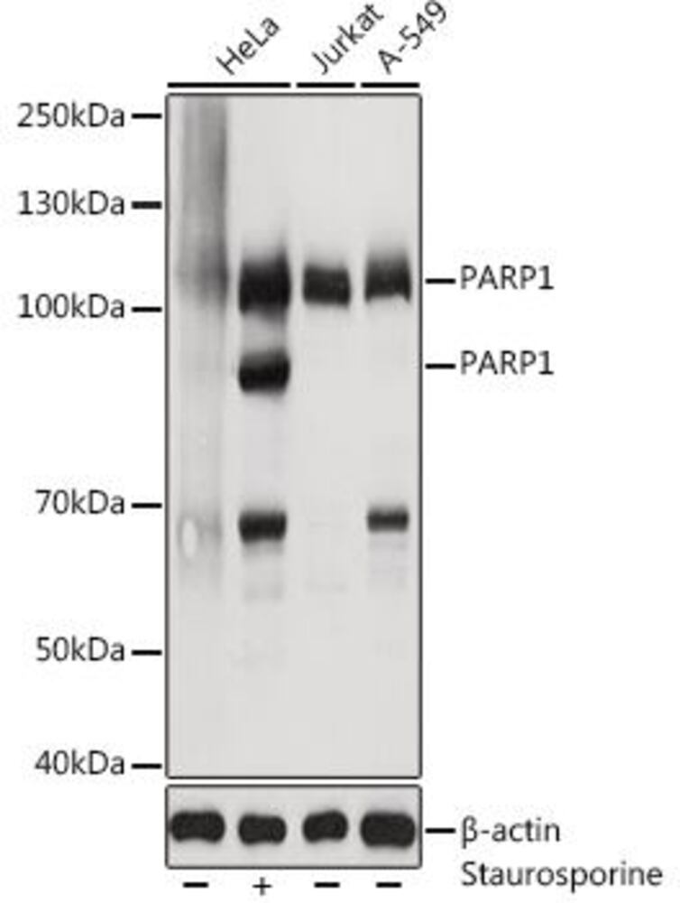 Anti-PARP1 Antibody, Density (D) 1 g/cm³, Storage temp. +4 °C - Luminix Health