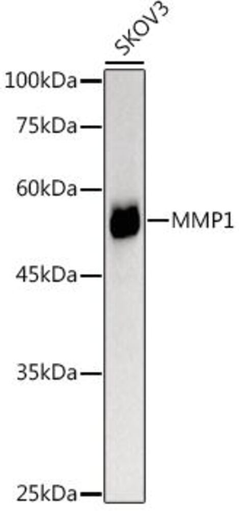 Anti-MMP1 Antibody, 100 µl - Luminix Health