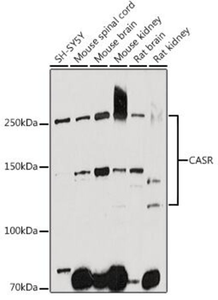 Anti-CaSR Antibody, 100 µl - Luminix Health