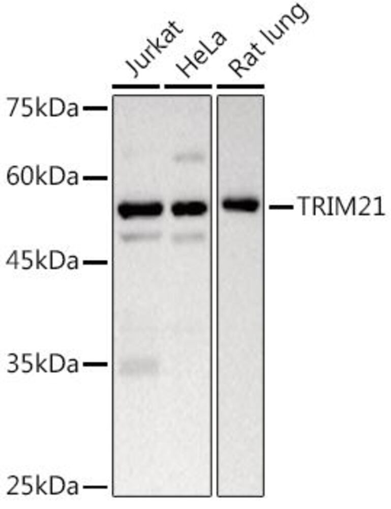 Anti-TRIM21 / SS-A Antibody, 100 µl - Luminix Health