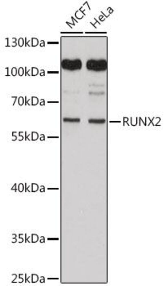 Anti-RUNX2 Antibody, 100 µl - Luminix Health