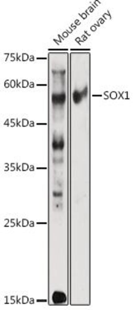 Anti-SOX1 Antibody, 100 µl - Luminix Health
