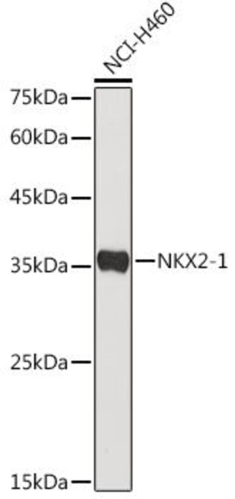 Anti-TTF1 Antibody, 100 µl - Luminix Health