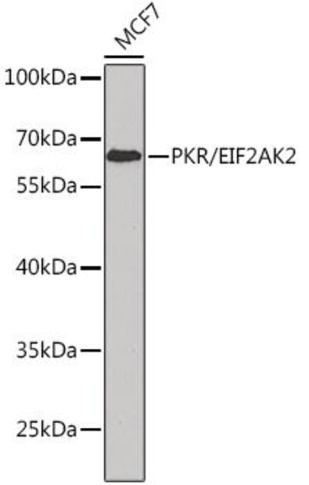 Anti-PKR Antibody, 100 µl - Luminix Health