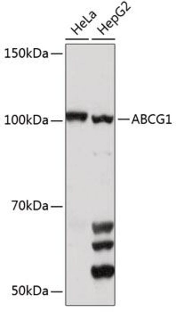 Anti-ABCG1 Antibody, 100 µl - Luminix Health