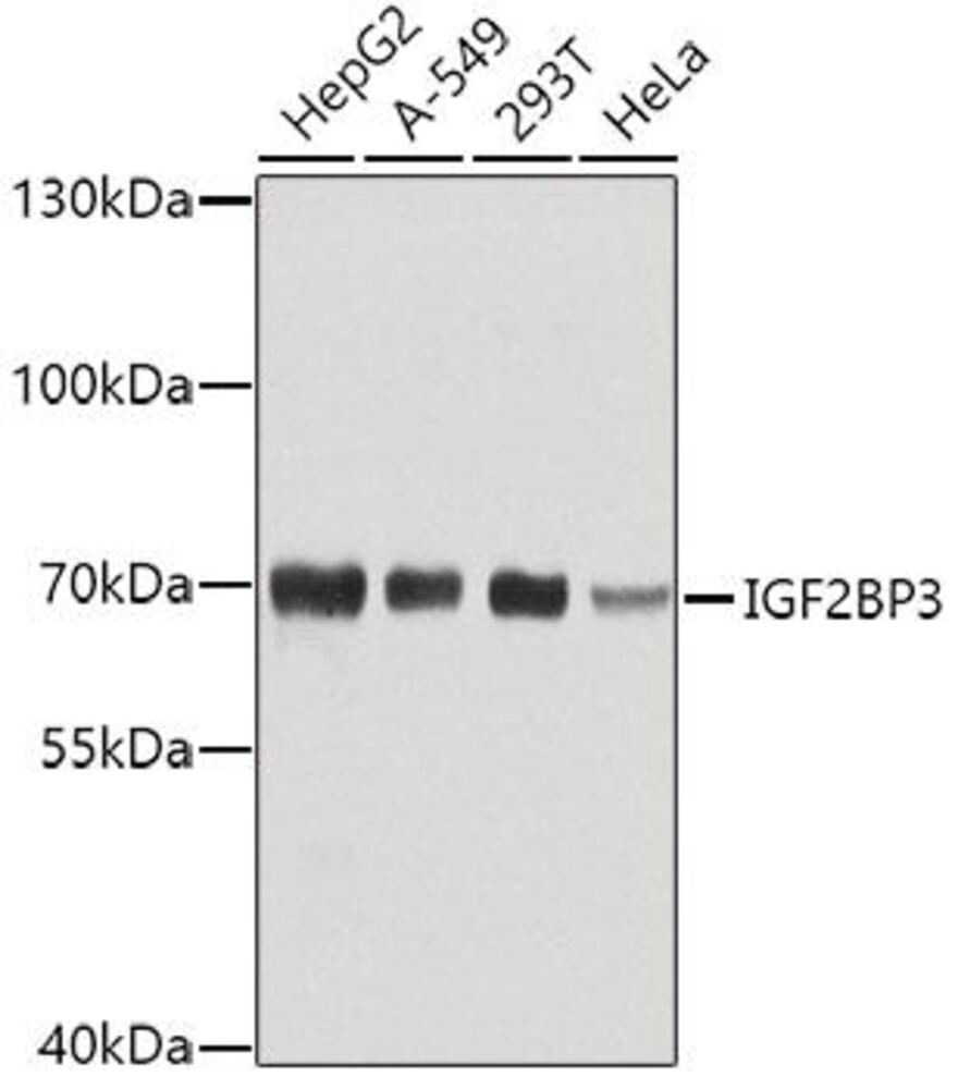 Anti-IMP3 Antibody, Density (D) 1 g/cm³, Storage temp. +4 °C - Luminix Health