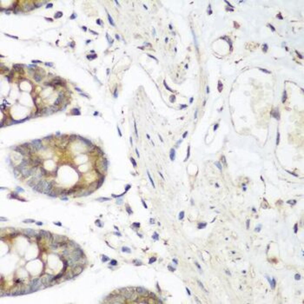 Anti-VEGF Receptor 3 Antibody, 100 µl - Luminix Health