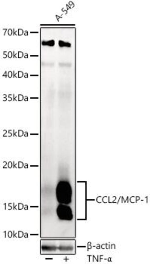 Anti-MCP1 Antibody, 100 µl - Luminix Health