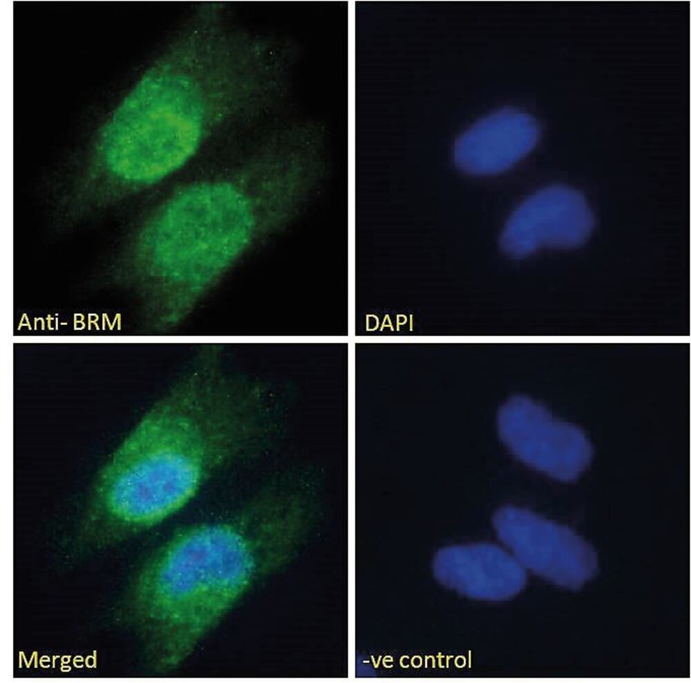Anti-BRM Antibody, 100 µg - Luminix Health
