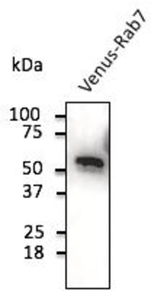 Anti-Venus Antibody, 300 µg - Luminix Health