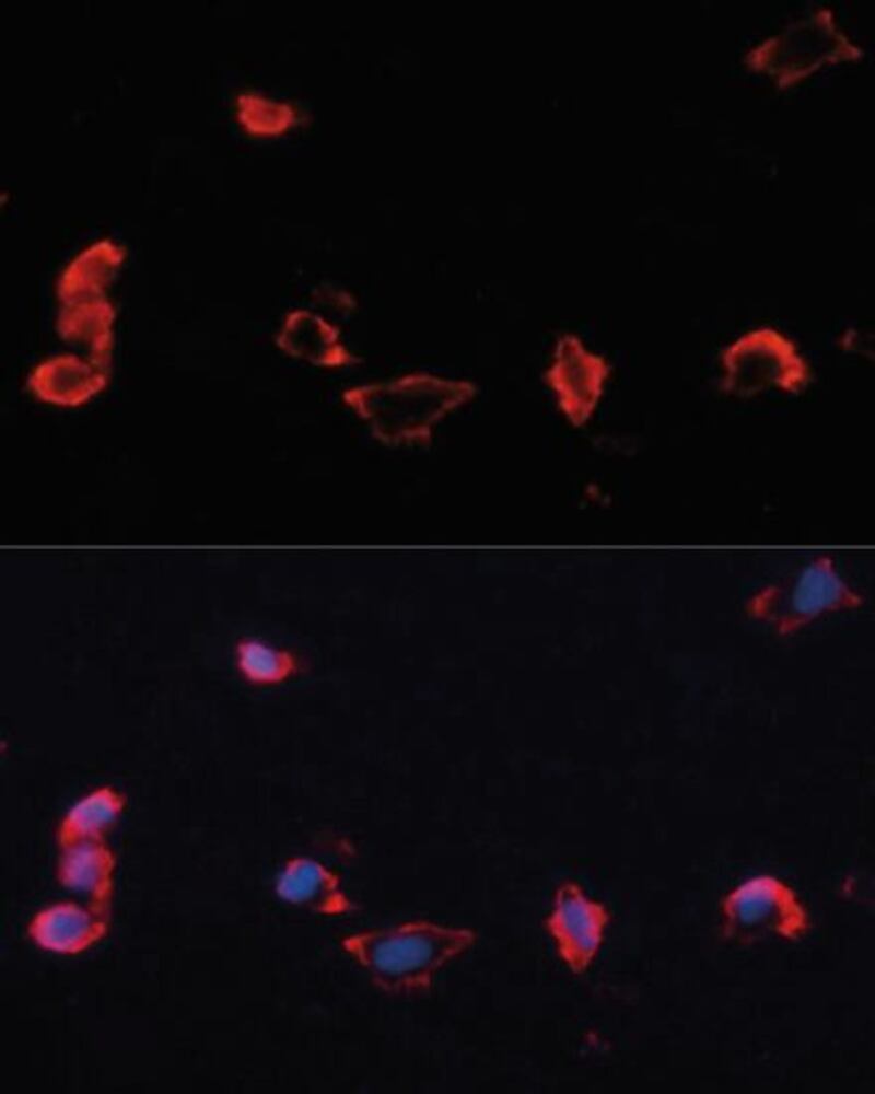 Anti-Caveolin 1 Antibody, 100 µl - Luminix Health