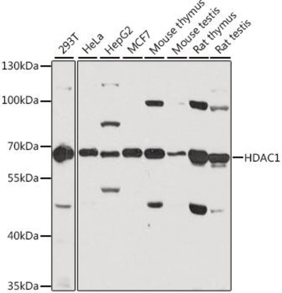 Anti-HDAC1 Antibody, 100 µl - Luminix Health