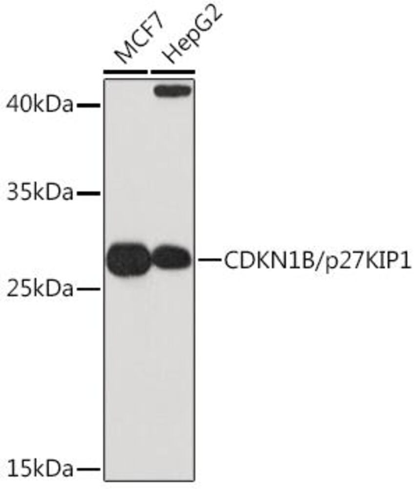 Anti-p27 KIP 1 Antibody, 100 µl - Luminix Health