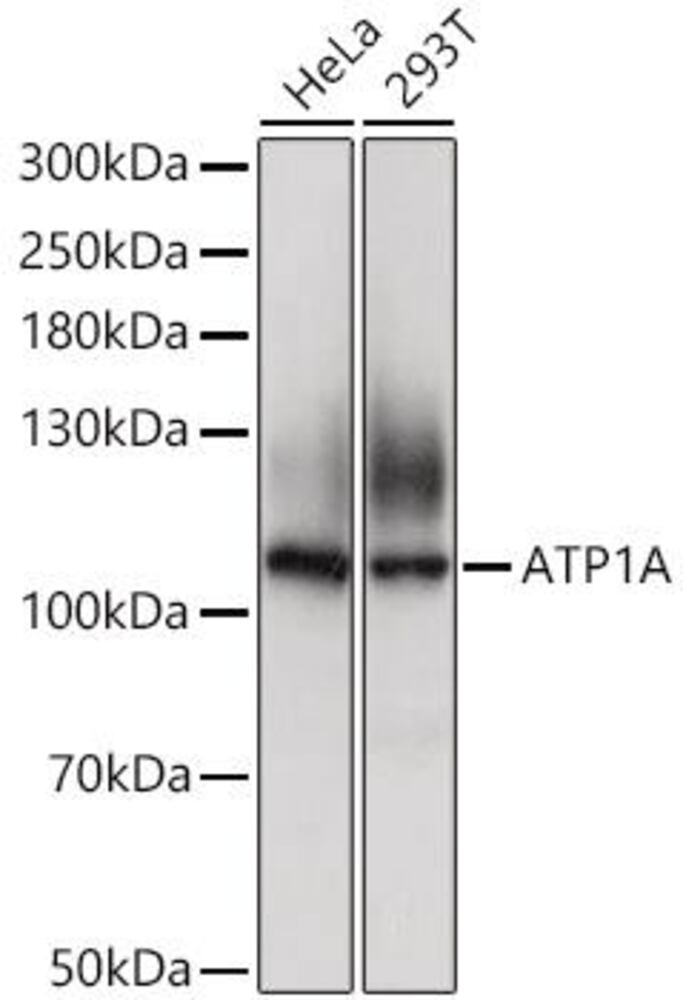 Anti-Sodium Potassium ATPase Antibody, 100 µl - Luminix Health