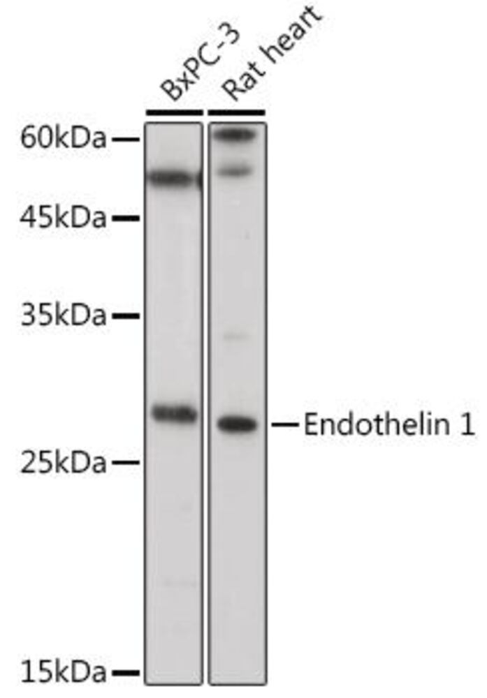 Anti-Endothelin 1 Antibody, 100 µl - Luminix Health