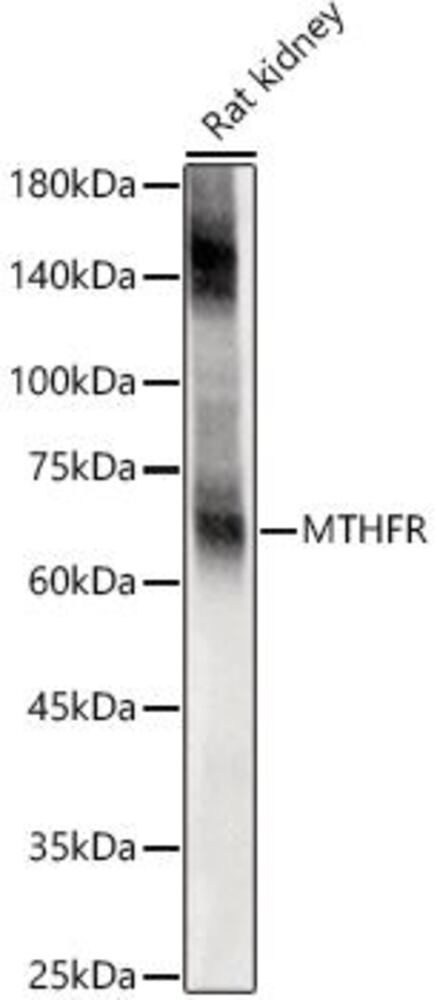 Anti-EAAT2 Antibody, 100 µl - Luminix Health
