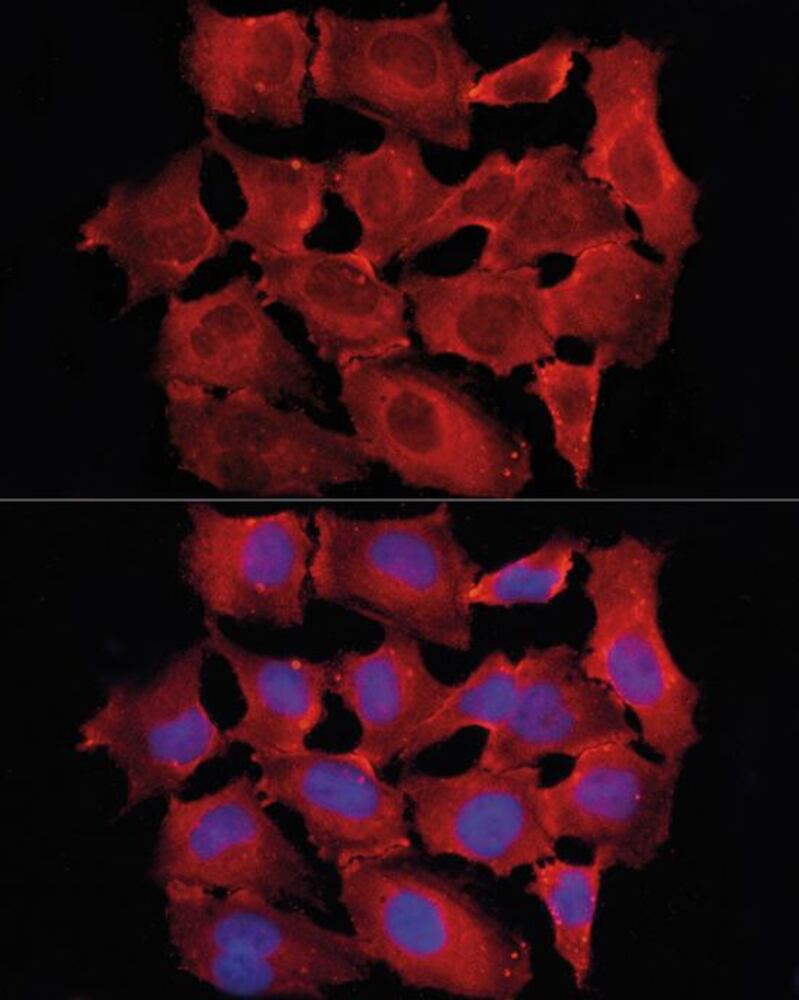 Anti-TRAF6 Antibody, Density (D) 1 g/cm³, Storage temp. +4 °C - Luminix Health