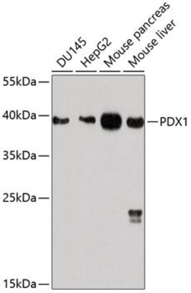Anti-PDX1 Antibody, 100 µl - Luminix Health