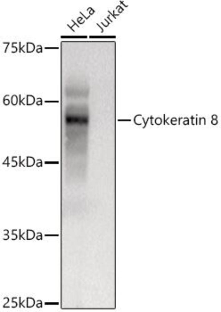 Anti-Cytokeratin 8 Antibody, 100 µl - Luminix Health