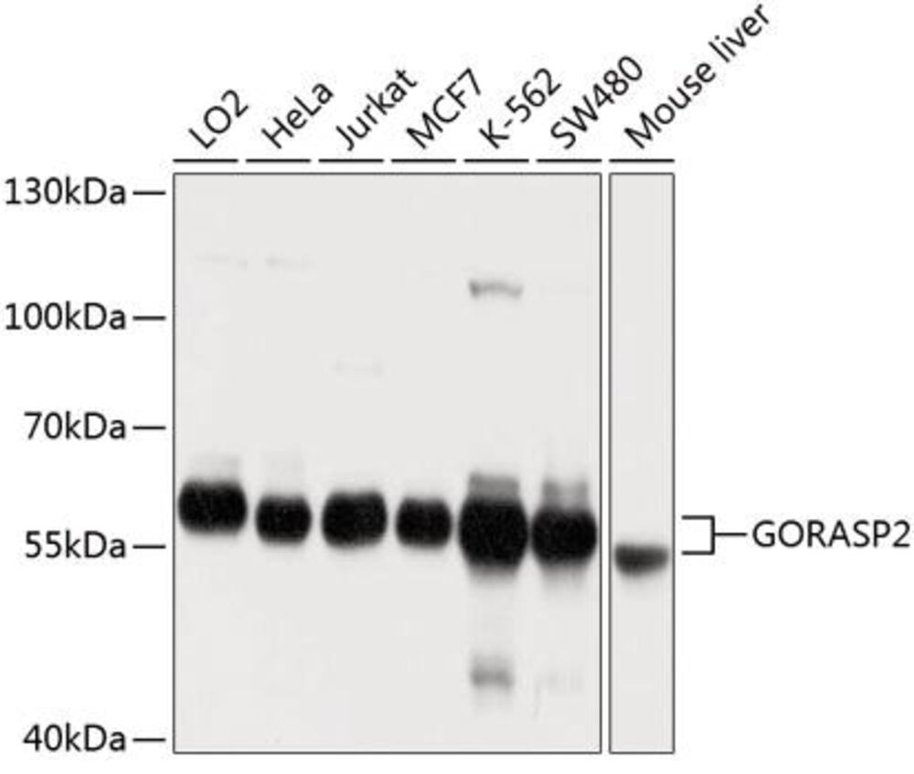 Anti-GORASP2 / GRASP55 Antibody, 100 µl - Luminix Health