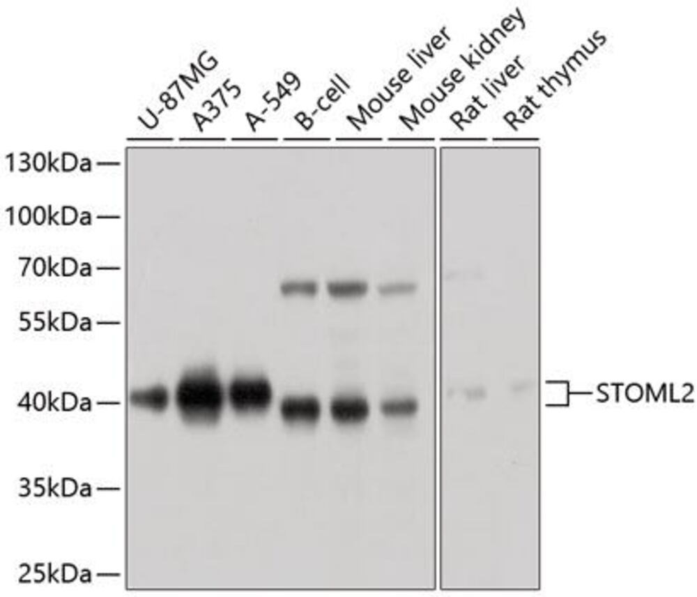 Anti-SLP-2 Antibody, 100 µl - Luminix Health