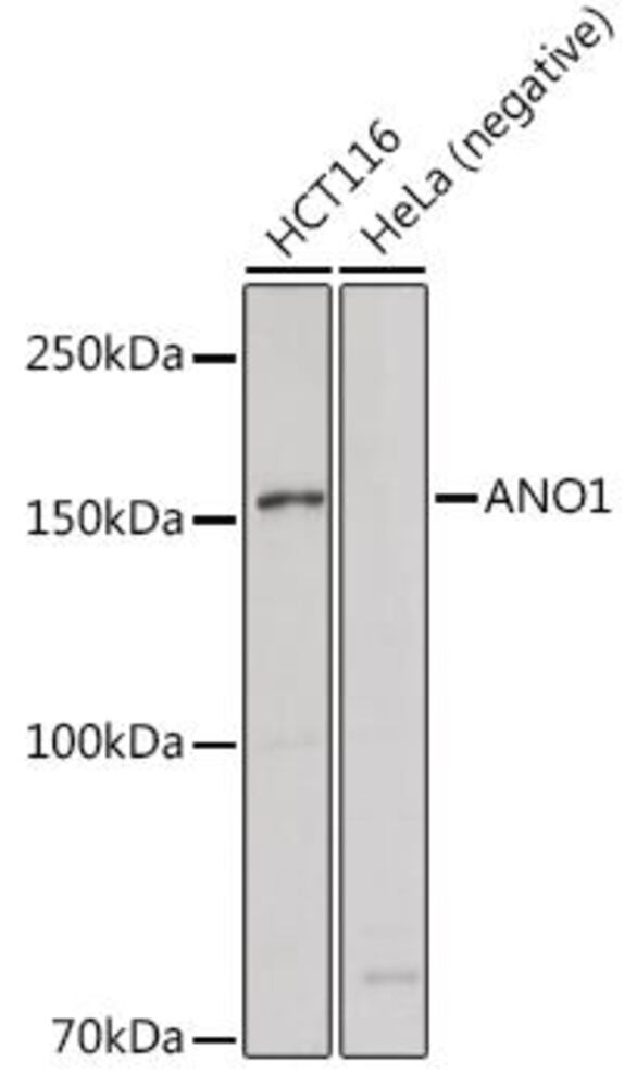 Anti-TMEM16A Antibody, 100 µl - Luminix Health