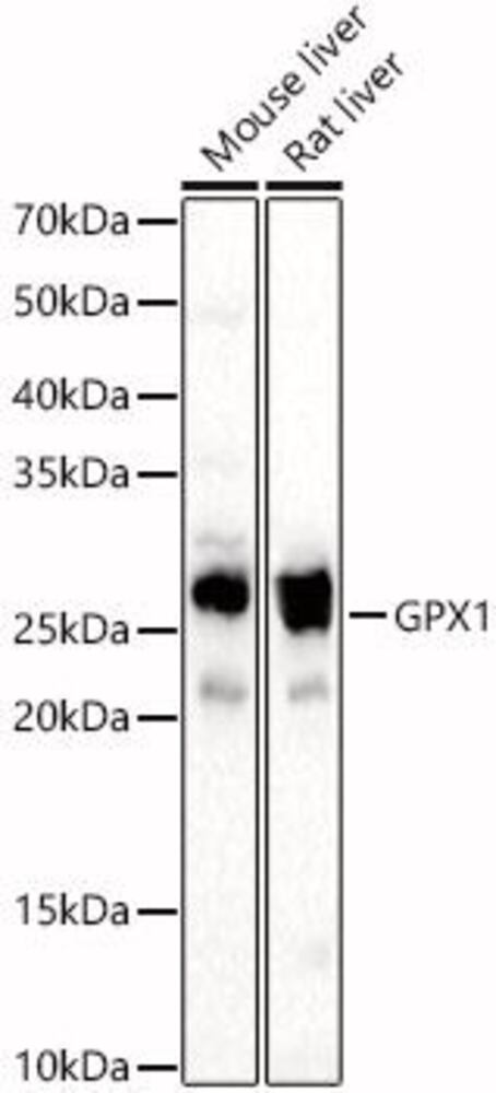 Anti-Glutathione Peroxidase 1 Antibody, 100 µl - Luminix Health