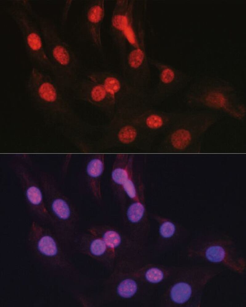 Anti-CTCF Antibody, Density (D) 1 g/cm³, Storage temp. +4 °C - Luminix Health