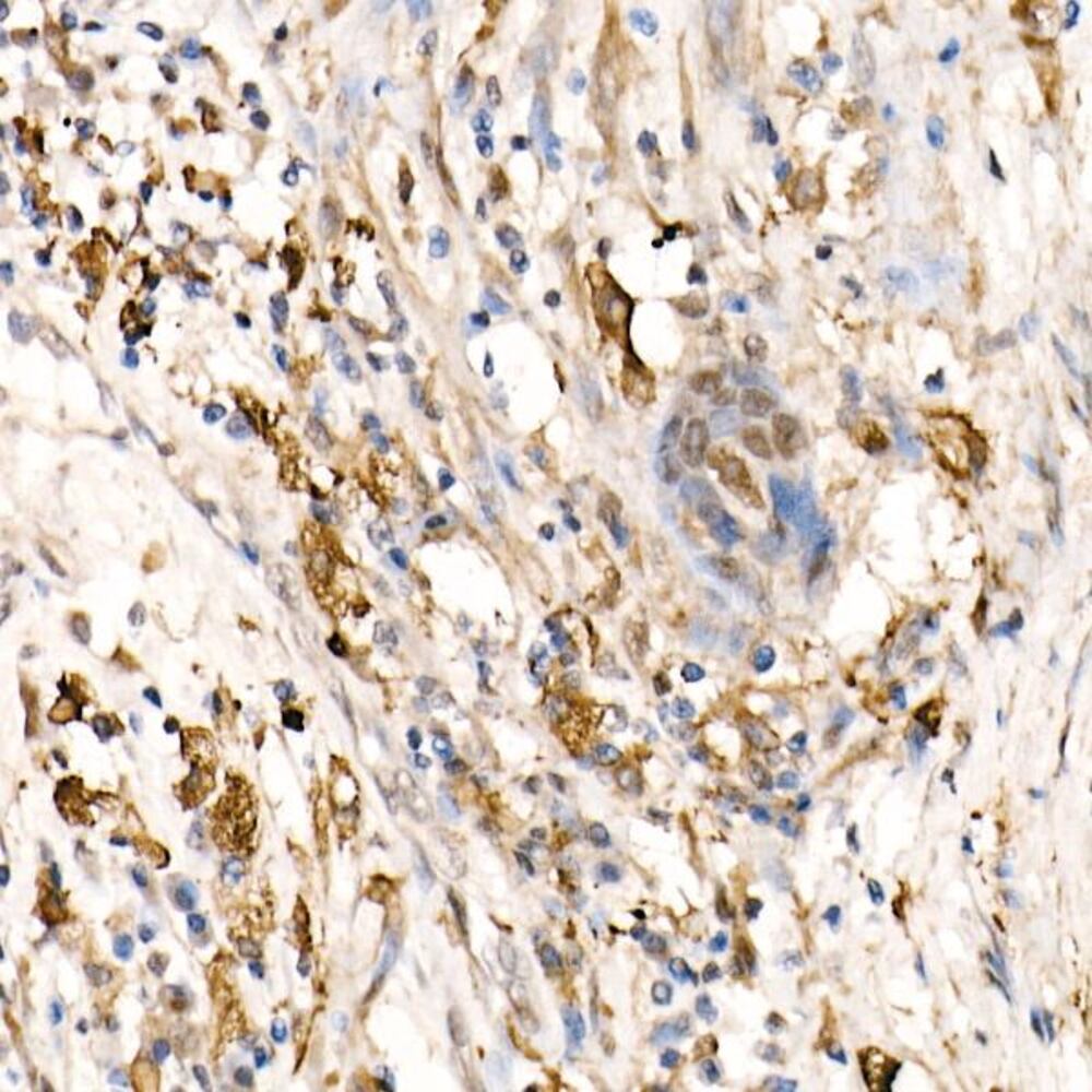 Anti-Ferritin Heavy Chain Antibody, 100 µl - Luminix Health