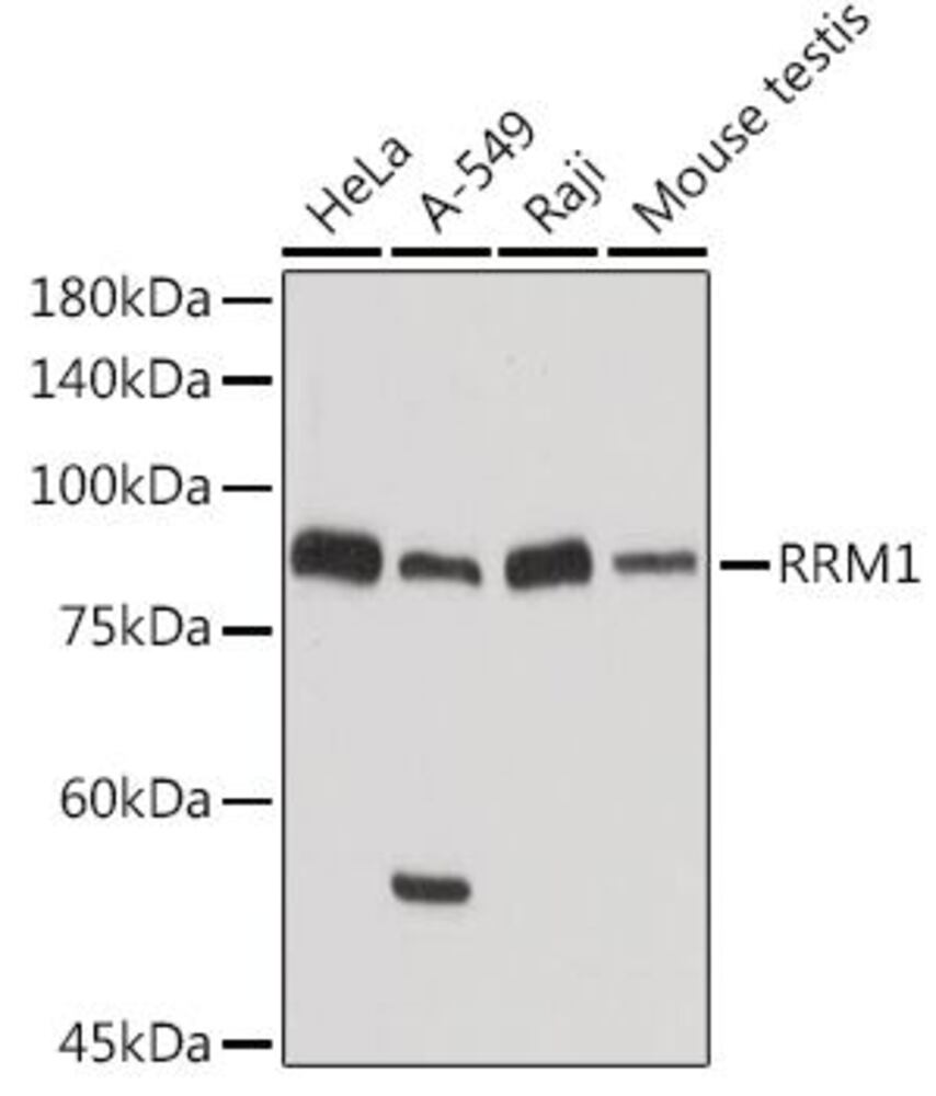 Anti-RRM1 Antibody, Density (D) 1 g/cm³, Storage temp. +4 °C - Luminix Health