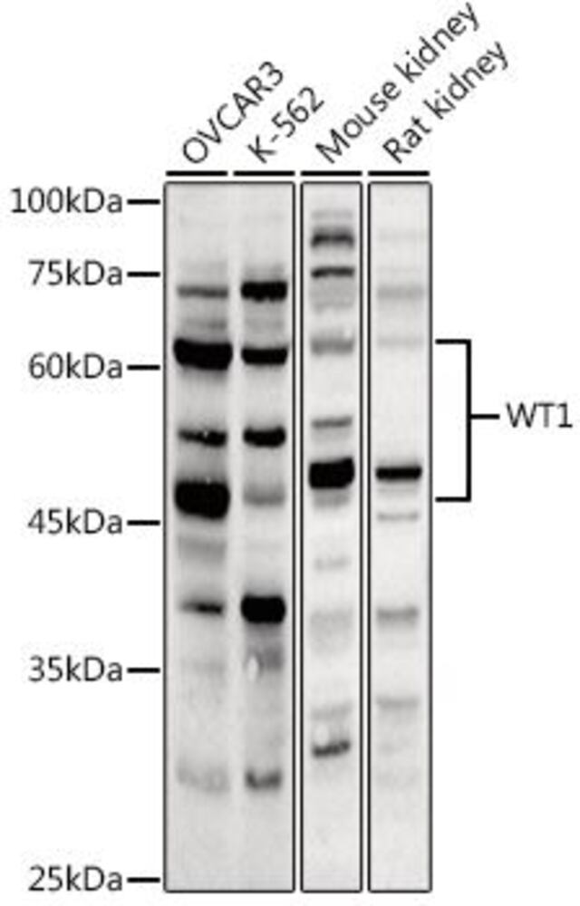 Anti-Wilms Tumor Protein Antibody, 100 µl - Luminix Health