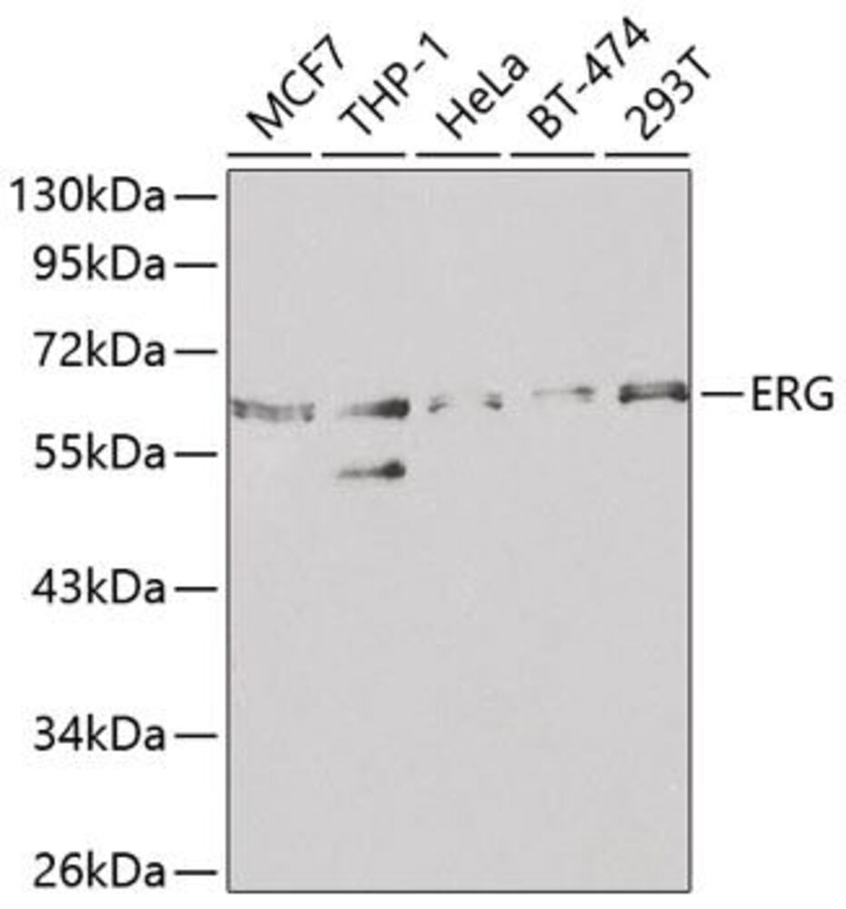 Anti-ERG Antibody, 100 µl - Luminix Health