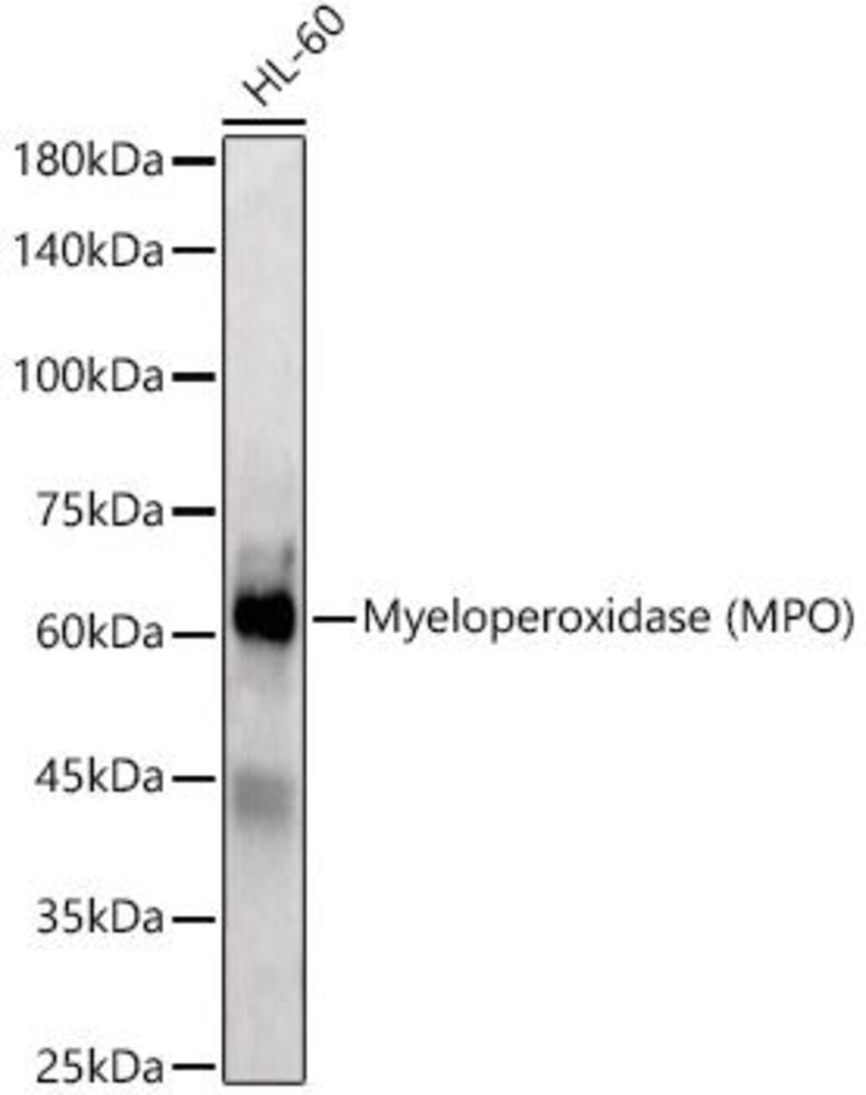 Anti-Myeloperoxidase Antibody, 100 µl - Luminix Health