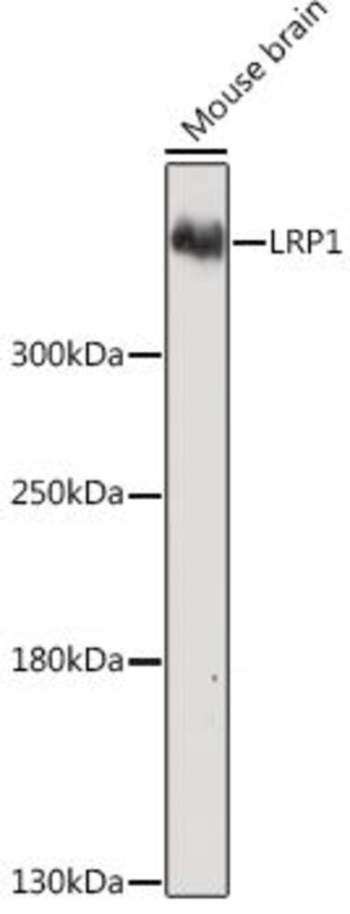 Anti-LRP1 Antibody, 100 µl - Luminix Health