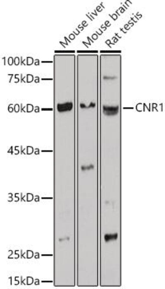 Anti-Cannabinoid Receptor I Antibody, 100 µl - Luminix Health
