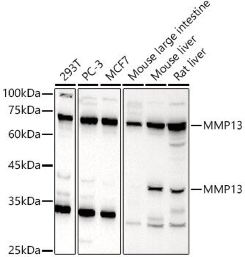 Anti-MMP13 Antibody, 100 µl - Luminix Health