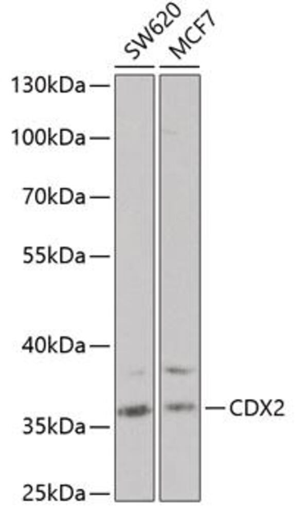 Anti-CDX2 Antibody, 100 µl - Luminix Health