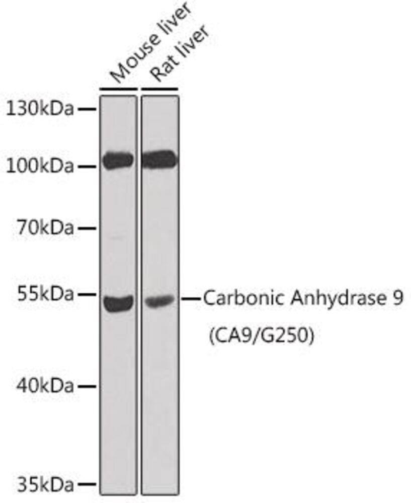 Anti-Carbonic Anhydrase 9 / CA9 Antibody, 100 µl - Luminix Health