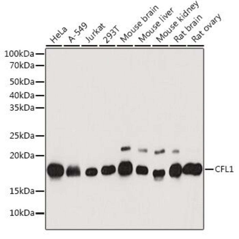 Anti-Cofilin Antibody, 100 µl - Luminix Health