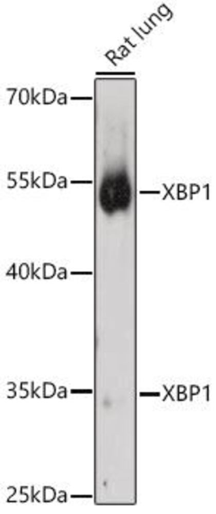 Anti-XBP1 Antibody, 100 µl - Luminix Health