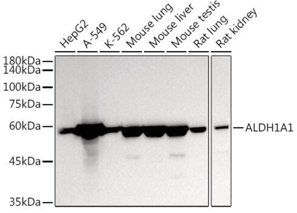 Anti-ALDH1A1 Antibody, 100 µl - Luminix Health