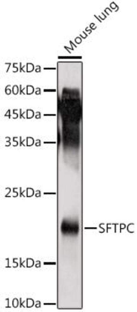 Anti-Prosurfactant Protein C Antibody, 100 µl - Luminix Health
